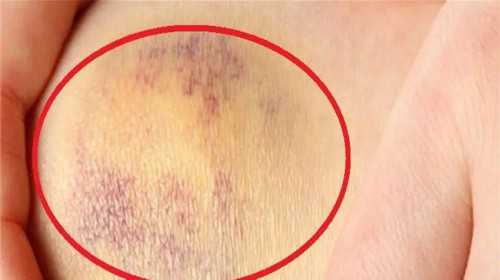 试管婴儿打降调针有哪些好处？揭秘提升试管成功率的关键环节